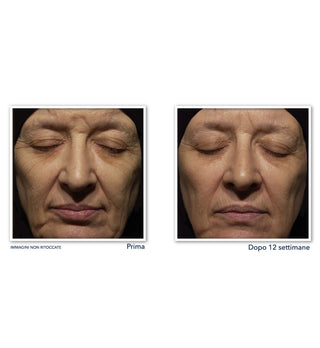 RETINOL CORREXION® Wrinkle Correct Crema Intensiva Notte