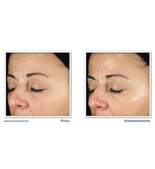 MULTI CORREXION® Revive + Glow Siero Viso Illuminante