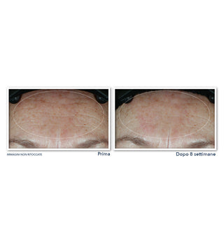 MULTI CORREXION® Hydrate & Plump Moisturizer with SPF 30