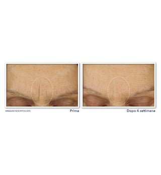 RETINOL CORREXION® Line Smoothing Max Hydration