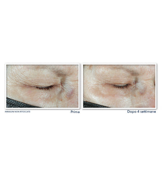 MULTI CORREXION® Hydrate & Plump Eye Cream