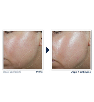 DERM CORREXION® Crema Viso