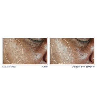 MULTI CORREXION® Even Tone + Lift Idratante con SPF30
