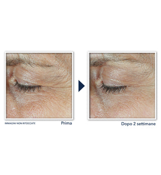 DERM CORREXION® Crema Contorno Occhi Doppia Azione
