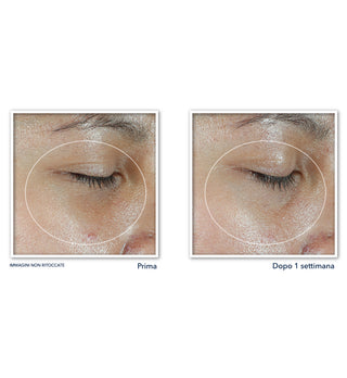 MULTI CORREXION® Revive + Glow Eye Balm