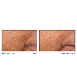 RETINOL CORREXION® Line Smoothing Siero Notte in Capsule 30 pz