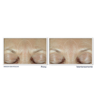DERM CORREXION® Fill + Treat Siero