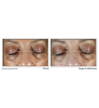MULTI CORREXION® Even Tone + Lift Crema Contorno Occhi