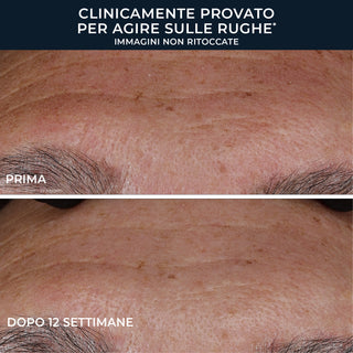 RoC RETINOL CORREXION® Deep Wrinkle Crema Viso Ricca