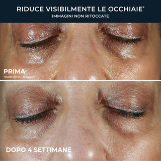 RoC MULTI CORREXION Even Tone + Lift Eye Cream
