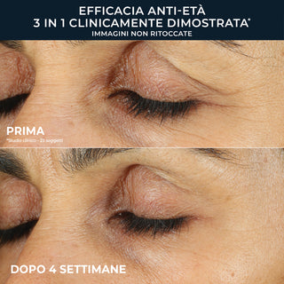 RoC Retinol Correxion Line Smoothing Eye Cream