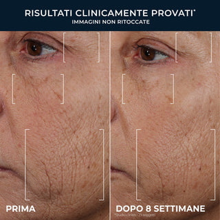 RETINOL CORREXION Line Smoothing Triple Serum