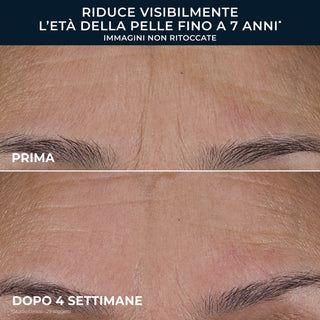 RETINOL CORREXION Line Smoothing Triple Serum