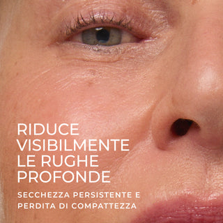 RoC RETINOL CORREXION® Deep Wrinkle Crema Viso Ricca