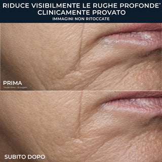 RoC RETINOL CORREXION® Deep Wrinkle Crema Viso Ricca
