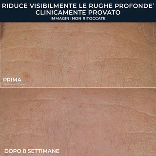 RoC RETINOL CORREXION® Deep Wrinkle Crema Viso Ricca