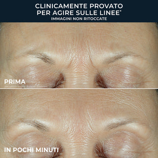 DERM CORREXION FILL + TREAT Wrinkle Repair Serum