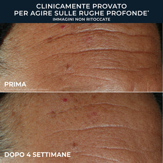 DERM CORREXION FILL + TREAT Wrinkle Repair Serum
